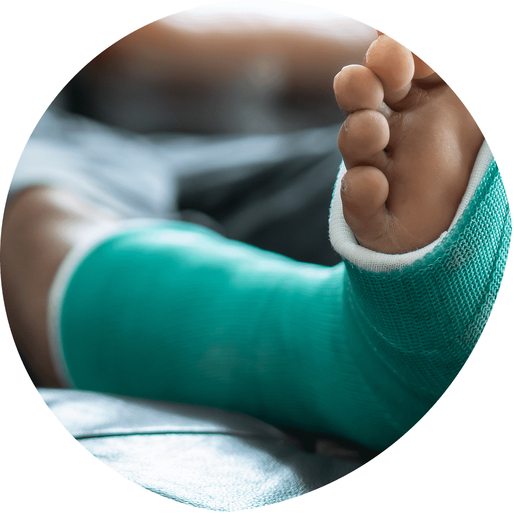 Orthopaedic Injury Claims