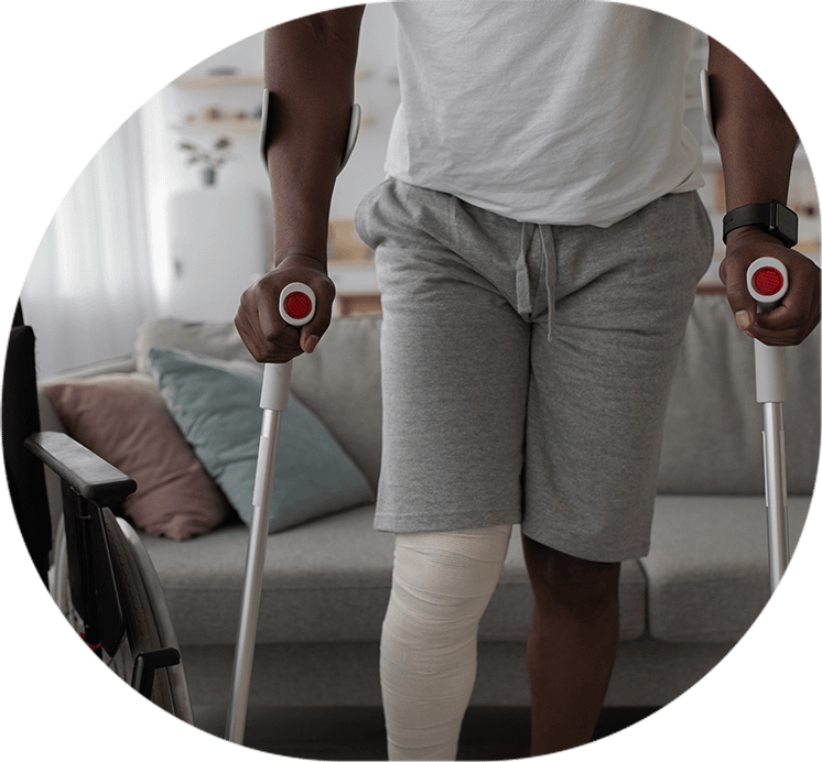 Leg Injury Compensation